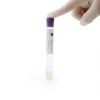 12ml /15ml PRP Tube High Quality Vacuum Blood Collection Tube for PRP Treatment