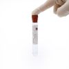 Virtuose Medical ACD Gel Platelet Rich Plasma Activator PRP Tube