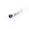 Medical Platelet Rich Plasma 9ml /10ml PRP Tube PRP with ACD Gel for Sale in Lab