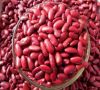 Black Kidney Beans/Whi...