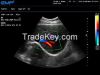 COLOR DOPPLER ULTRASOUND SYSTEM