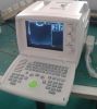 810 Digital Ultrasound...