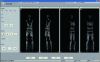 Millimetric Wave 3D Human Body Imaging Security Check System
