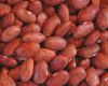Kidney Beans, Black Beans, Lentils, Chickpeas, Mung Beans, Soybeans