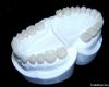 Dental zircon PFM porcelain crown supply