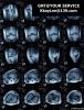 PET Medical X-ray Lase...