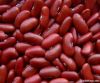 Kidney Beans (White | Red | Light Speckled | Black | Purple Speckled)