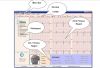 3 lead ECG