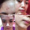 Fairy Skin Facial Derma set