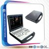 laptop color doppler u...