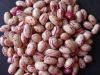 2017New Crop light speckled kidney beans