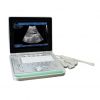 SS-9 Laptop Ultrasound B Scanner
