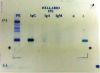 IMMUNOFIXATION ELECTROPHORESIS (IFE)