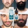 New Arrival Organic Beard Length Enhancer Regrowth Essential Oil Men Private Label Beard Growth Oil