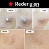 [Redergen] Knee + Elbow Brightening Cream, Dead Cell, Bleaching Whitening Cream, No.1 Aesthetic, Professional, 50g