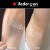 [Redergen]Miracle Axilla Underarm, Armpit Brightening Bleaching Whitening Cream, No.1 Aesthetic, Professional, 50g
