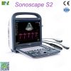 Factory direct sales ecografo sonoscape s2 price lis