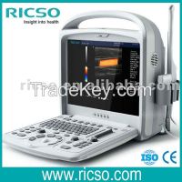 Hot Selling Portable doppler ultrasound Model RS-2