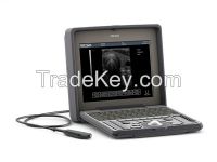 Vetar V1 B/W Portable Digital Ultrasound Machine 