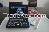2016 Laptop Full-digital Ultrasound Scanner EXRH-500E for Sale