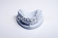 Dental Gypsum ISO Type 3