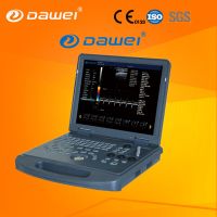 portable doppler ultrasound machine &amp; laptop color doppler ultrasound scanner