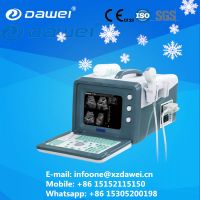 Obstetrics &amp; gynecology ultrasound equipments &amp; portable ultrasound machine