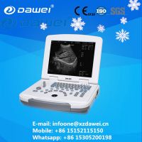 portable sonar machine price &amp; ultrasound scanner laptop