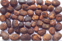 Gallstones