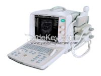 Full Digital Portable B Mode Ultrasound Scanner