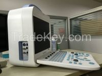 Ce Approved Portable 3d Color Doppler Ultrasound Scanner