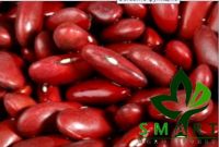 Smart Agro Invest LLC : Kidney Beans "Color Bean"  from Ukraine