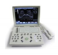 Laptop ultrasound machine ultrasound scanner high resolution