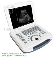 Hot Selling Full-digital B/W Laptop Color Doppler Ultrasound Scanner	YJ-U580