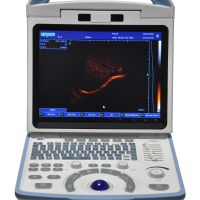 A65 Full Digital Black & White Portable 3D Ultrasound Scanner