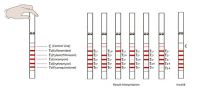 Sulfonamides &amp; Tylosin/Tilmicosin &amp; Lincomycin &amp; Erythromycin &amp; Fluoroquinolones Rapid Test Kit
