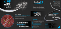 WaterJET THROMBUS MANAGEMENT