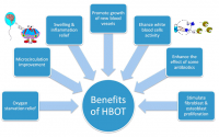 HBOT 1.5ATA hyperbaric oxygen chamber for home rehabilitation