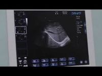 Full Digital Hospital Diagnosis Equipment Ultrasound Scanner DW-370