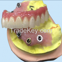 Dental Implant Bar For Crowns And Bridge- China Dental Lab
