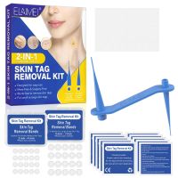 2 IN 1 Skin Tag and Wart Removal Kit Rubber Band for Girls/Women