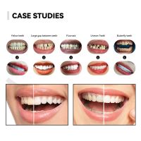 Glass Ceramic Teeth