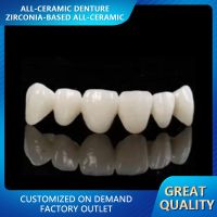 All Ceramic Dentu...