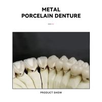 Metal Porcelain Denture - Major Brand