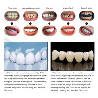 All Ceramic Dentures - Zirconia Base