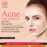 Acne Scar Specialist