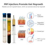 Prp tube platelet sodium citrate acd gel biotin prp tube for hair loss