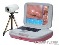 Colposcopy Imaging System