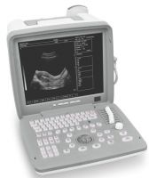 Portable Ultrasound Scanner