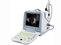 Full Digital Ophthalmic A/B Ultrasound Scanner (ODU5)